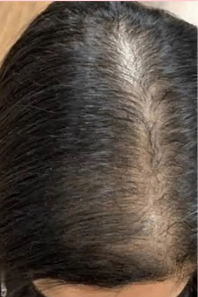 After Vista Hair Oil